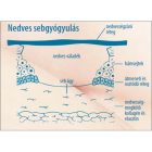 Lansinoh mellbimbóvédő krém /40g/